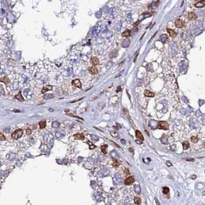 Immunohistochemistry-Paraffin: LAP1B Antibody [NBP2-47402]