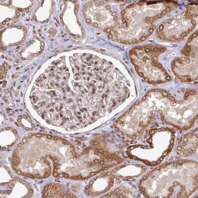 Immunohistochemistry-Paraffin: LAP1B Antibody [NBP2-47403]