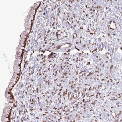 Immunohistochemistry-Paraffin: LAP1B Antibody [NBP2-47403]