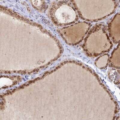 Immunohistochemistry-Paraffin: LAP1B Antibody [NBP2-47403]
