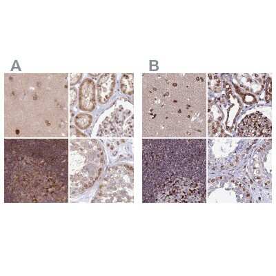 Immunohistochemistry-Paraffin: LAP1B Antibody [NBP2-47403]