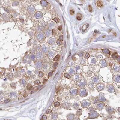 Immunohistochemistry-Paraffin: LAP1B Antibody [NBP2-47403]