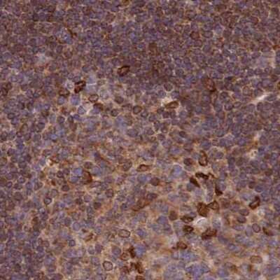 Immunohistochemistry-Paraffin: LAP1B Antibody [NBP2-47403]