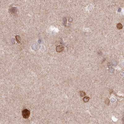 Immunohistochemistry-Paraffin: LAP1B Antibody [NBP2-47403]