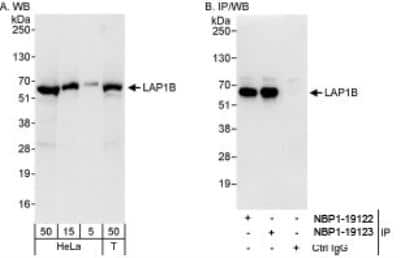 Western Blot: LAP1B Antibody [NBP1-19122]