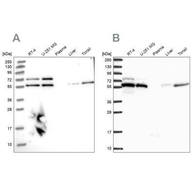 Western Blot: LAP1B Antibody [NBP2-47402]