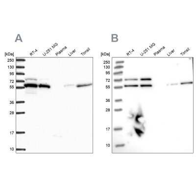 Western Blot: LAP1B Antibody [NBP2-47403]