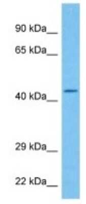 Western Blot: LAP1B Antibody [NBP3-09967]