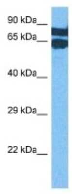 Western Blot: LAP1B Antibody [NBP3-10001]