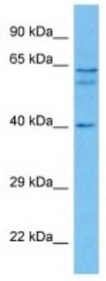 Western Blot: LAP1B Antibody [NBP3-10080]