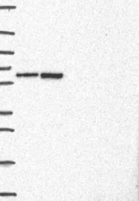 Western Blot: LAP1B Antibody [NBP3-17660]