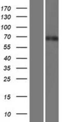 Western Blot: LAP1B Overexpression Lysate [NBP2-07143]