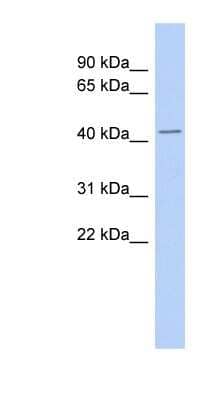 Western Blot: Thymopoietin/LAP2 Antibody [NBP1-59403]