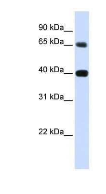 Western Blot: Thymopoietin/LAP2 Antibody [NBP1-59489]