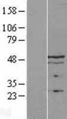 Western Blot: Thymopoietin/LAP2 Overexpression Lysate [NBL1-17119]