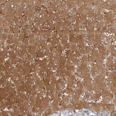 Immunohistochemistry-Paraffin: LAP3 Antibody [NBP1-82847]