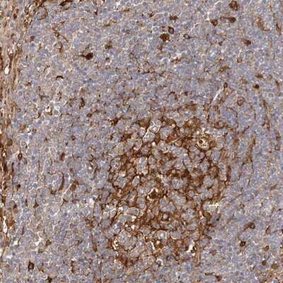 Immunohistochemistry-Paraffin: LAP3 Antibody [NBP1-82847]