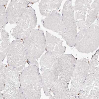 Immunohistochemistry-Paraffin: LAP3 Antibody [NBP1-82847]