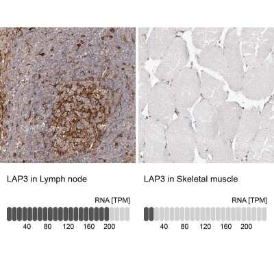 Immunohistochemistry-Paraffin: LAP3 Antibody [NBP1-82847]