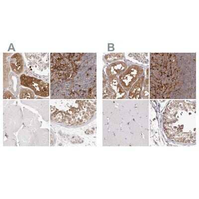 Immunohistochemistry-Paraffin: LAP3 Antibody [NBP1-82847]