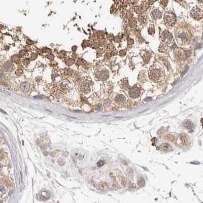 Immunohistochemistry-Paraffin: LAP3 Antibody [NBP1-82847]