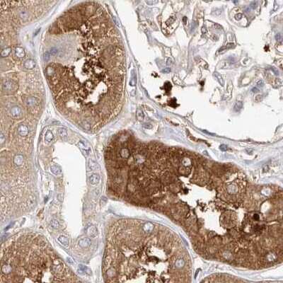 Immunohistochemistry-Paraffin: LAP3 Antibody [NBP1-82847]