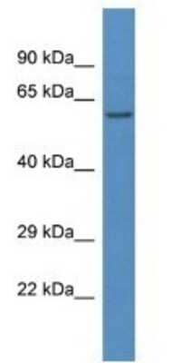 Western Blot: LAP3 Antibody [NBP1-79642]