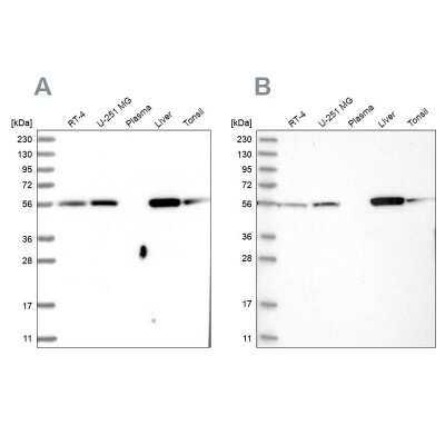 Western Blot: LAP3 Antibody [NBP1-82847]