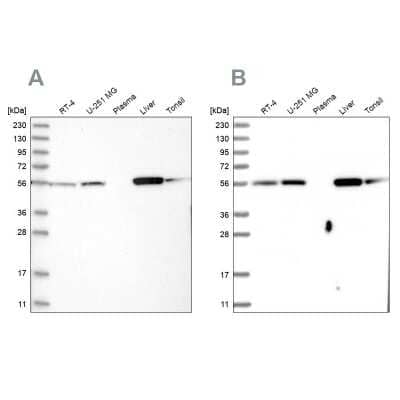 Western Blot: LAP3 Antibody [NBP1-82848]