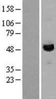 Western Blot: LAP3 Overexpression Lysate [NBL1-12435]