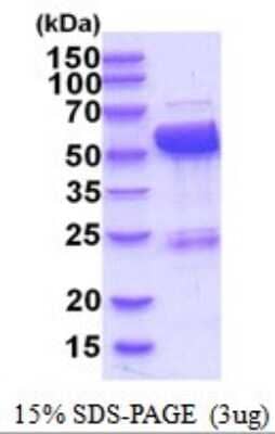 SDS-PAGE: Recombinant Human LAP3 His Protein [NBP2-52032]