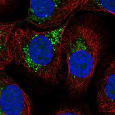 Immunocytochemistry/ Immunofluorescence: LAPTM4A Antibody [NBP2-57151]