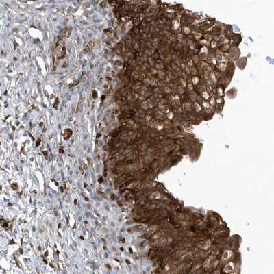 Immunohistochemistry-Paraffin: LAPTM4A Antibody [NBP1-81645]