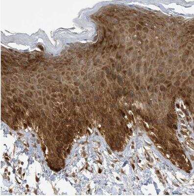 Immunohistochemistry-Paraffin: LAPTM4A Antibody [NBP1-81646]