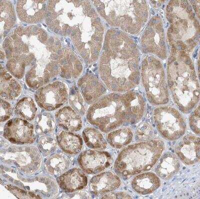 Immunohistochemistry-Paraffin: LAPTM4A Antibody [NBP1-81646]