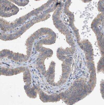 Immunohistochemistry-Paraffin: LAPTM4A Antibody [NBP1-81646]