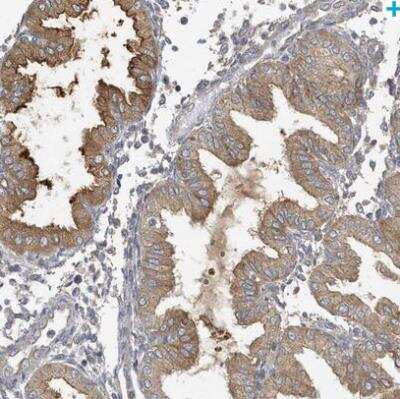 Immunohistochemistry-Paraffin: LAPTM4A Antibody [NBP1-81646]