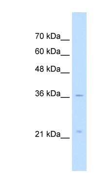 Western Blot: LAPTM4A Antibody [NBP1-59964]