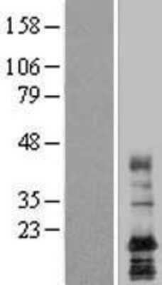 Western Blot: LAPTM4A Overexpression Lysate [NBL1-12436]