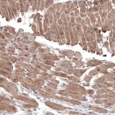 Immunohistochemistry: LAPTM4B Antibody (CL5287) [NBP2-61157]