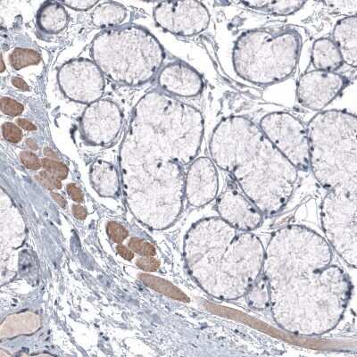 Immunohistochemistry: LAPTM4B Antibody (CL5287) [NBP2-61157]