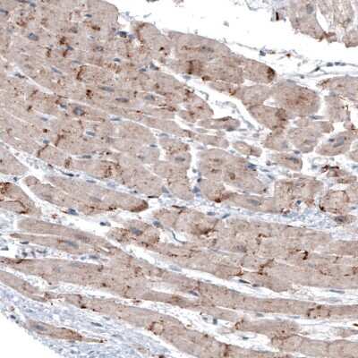 Immunohistochemistry: LAPTM4B Antibody (CL5289) [NBP2-61158]