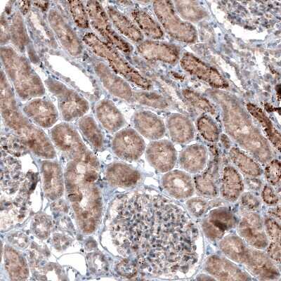 Immunohistochemistry: LAPTM4B Antibody (CL5289) [NBP2-61158]