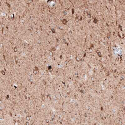 Immunohistochemistry: LAPTM4B Antibody (CL5289) [NBP2-61158]