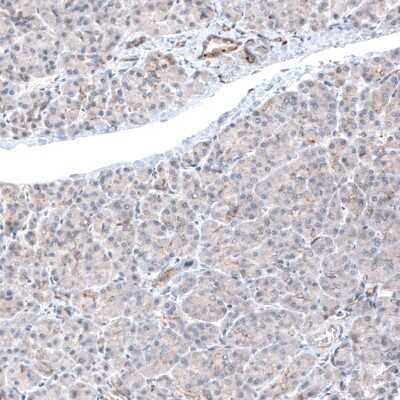 Immunohistochemistry: LAPTM4B Antibody (CL5289) [NBP2-61158]
