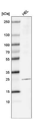 Western Blot: LAPTM4B Antibody (CL5289) [NBP2-61158]