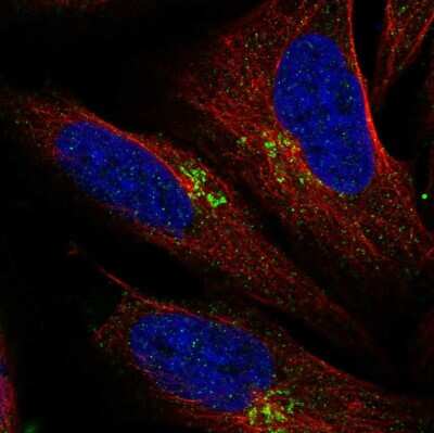 Immunocytochemistry/ Immunofluorescence: LAPTM4B Antibody [NBP2-56880]