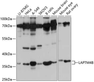 Western Blot: LAPTM4B AntibodyAzide and BSA Free [NBP3-04859]