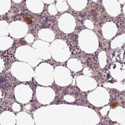 Immunohistochemistry-Paraffin: LAPTM5 Antibody [NBP2-14183]