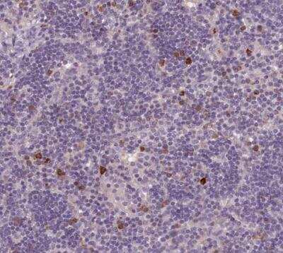 Immunohistochemistry-Paraffin: LAPTM5 Antibody [NBP2-14183]